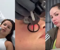 Juliette compartilha reações a procedimentos no rosto com esperma de salmão