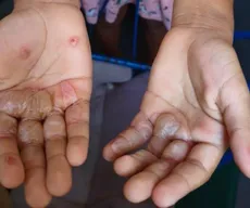 Paraíba tem a 2ª maior taxa de denúncias de violência contra crianças e adolescentes no Nordeste