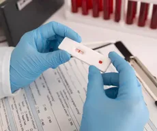 SUS passa a oferecer teste rápido para diagnóstico de dengue