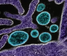 Nipah: risco do vírus para o Brasil é baixo; entenda