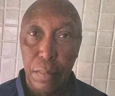 Bombeiro militar aposentado é suspeito de atropelar produtor cultural em João Pessoa, diz polícia