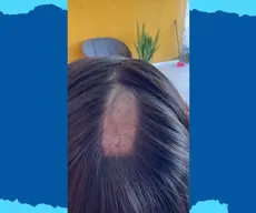 Mulher denuncia ter tido parte da cabeça raspada durante exame toxicológico para CNH em Sapé