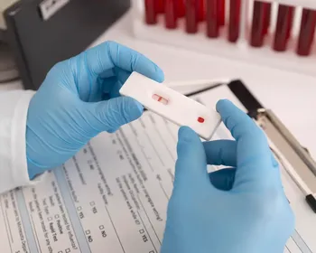 SUS passa a oferecer teste rápido para diagnóstico de dengue