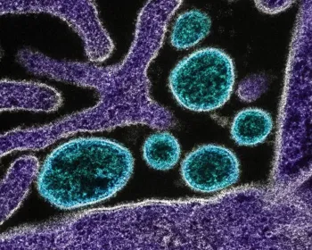 Vírus Nipah: saiba o que é a doença de alta letalidade que provoca surto na Índia