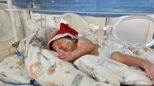 
				
					Bebês internados em UTI de hospital em João Pessoa vestem roupas de Natal e pais celebram
				
				