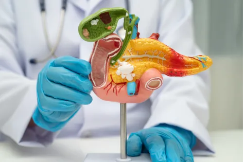 
				
					Cirurgia do governador acende alerta: o que todo mundo precisa saber sobre pedras na vesícula
				
				