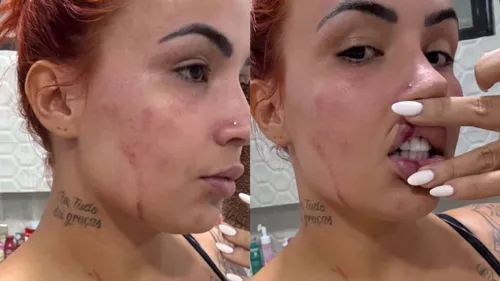 
				
					Influenciadora é perseguida e atingida com um tiro na mão, em João Pessoa
				
				