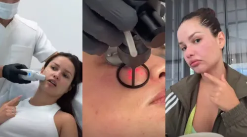 
				
					Juliette compartilha reações a procedimentos no rosto com esperma de salmão
				
				