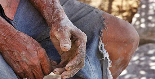 
				
					Paraíba tem 19 empregadores na nova “Lista Suja” do trabalho escravo do governo
				
				