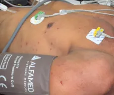 Pessoas são atacadas por abelhas em acampamento e uma sofre mais de 100 picadas, em João Pessoa