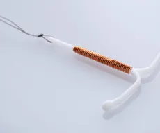 Planos de saúde terão que cobrir DIU hormonal em casos de endometriose; entenda