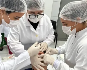 UFPB produz próteses artesanais e promove reabilitação de pessoas com deformidades faciais