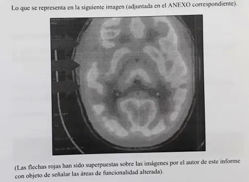 
					Chacina de Pioz: psiquiatras analisam comportamento de assassino 10 anos após crime
				
				