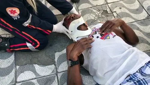 
				
					Ex-jogador de futebol é atropelado por moto em avenida de Mangabeira
				
				