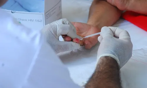 
                                        
                                            Casos de HIV/Aids têm redução de 39% na Paraíba em 2019
                                        
                                        