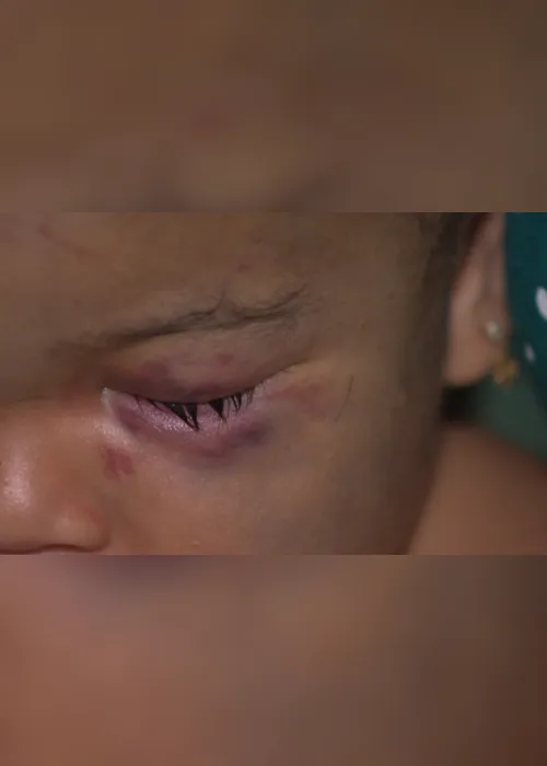 
                                        
                                            Mãe confessa ter agredido filho de 11 meses que teve traumatismo craniano
                                        
                                        
