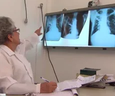Casos de tuberculose aumentam na Paraíba, informa SES