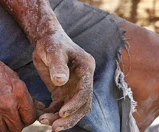 Após resgate de 843 trabalhadores, MPT investiga mais 41 casos de trabalho escravo na Paraíba