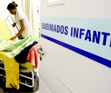 Líquidos em alta temperatura geram 64% dos queimados atendidos no Trauma