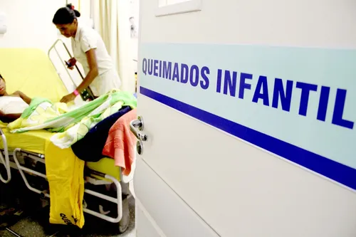 
				
					Líquidos em alta temperatura geram 64% dos queimados atendidos no Trauma
				
				
