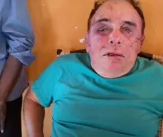 Candidato a prefeito de Santa Teresinha é agredido durante assalto a fazenda