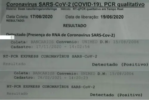 
				
					Suspeita de reinfecção por Covid-19 é investigada após adolescente testar positivo três vezes
				
				