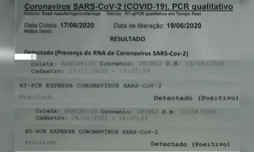
				
					Suspeita de reinfecção por Covid-19 é investigada após adolescente testar positivo três vezes
				
				