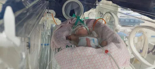 
				
					Mãe se emociona com primeiro quilo da filha internada em UTI neonatal na Paraíba
				
				