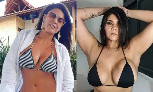 
                                        
                                            Cantora fala sobre cirurgia para retirar silicone, após complicações
                                        
                                        