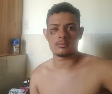 Torcedor atingido por bala de borracha em jogo do Campinense relata momentos de angústia