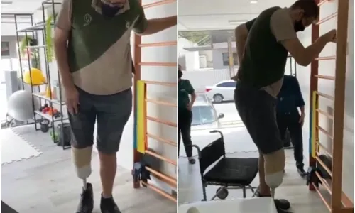
                                        
                                            Ninão fica em pé pela primeira vez com prótese da perna após cirurgia
                                        
                                        