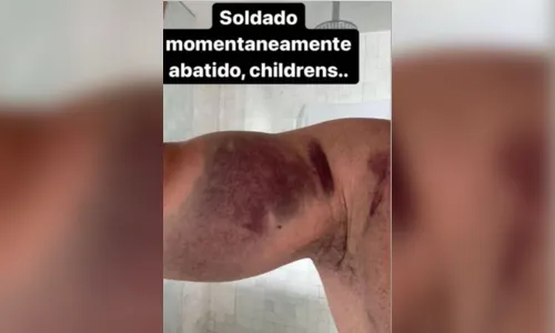 
				
					Deputado estadual Caio Roberto exagera na "malhação" e rompe tendão do peitoral; veja as fotos
				
				