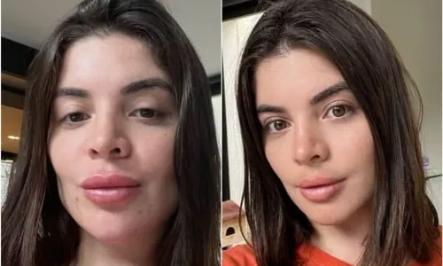 
                                        
                                            Gkay retira preenchimento labial e mostra o 'antes e depois' a seguidores
                                        
                                        