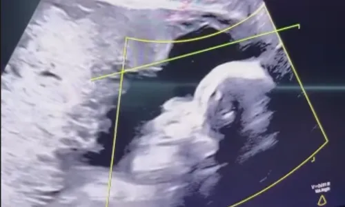 
				
					Luva de Pedreiro e Távila Gomes compartilham ultrassom do primeiro filho
				
				